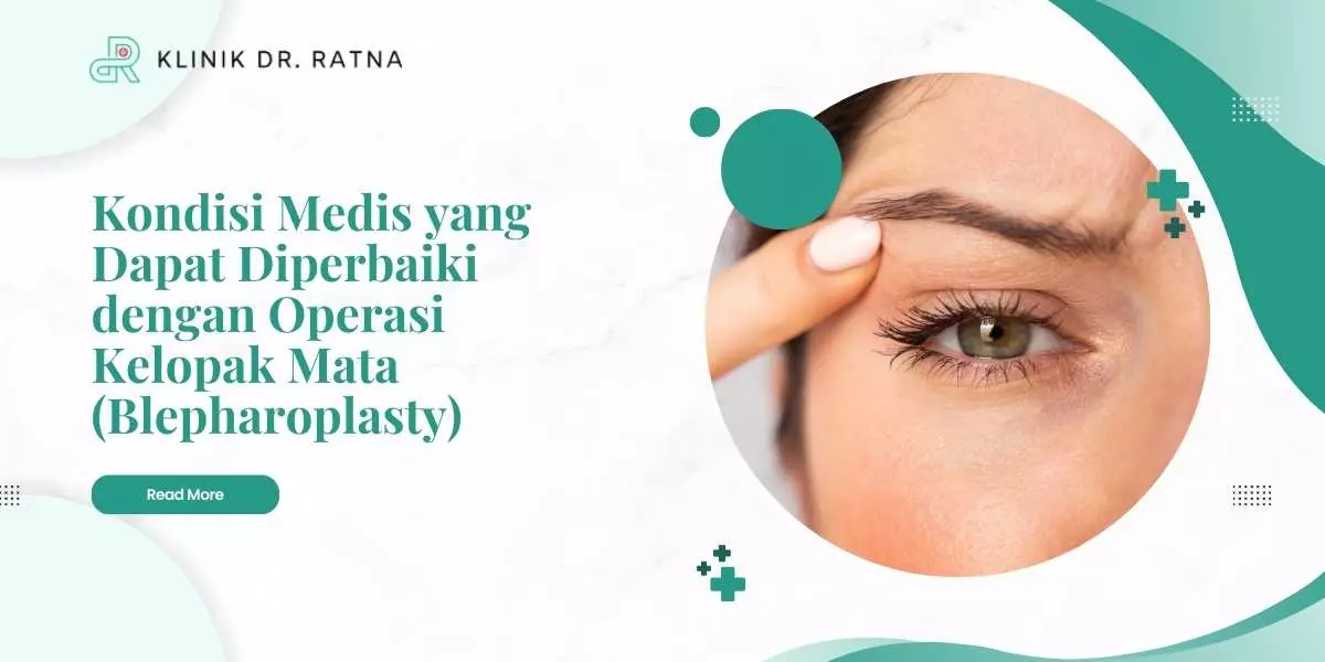 kondisi medis yang dapat diperbaiki dengan operasi kelopak mata blepharoplasty 01095818756