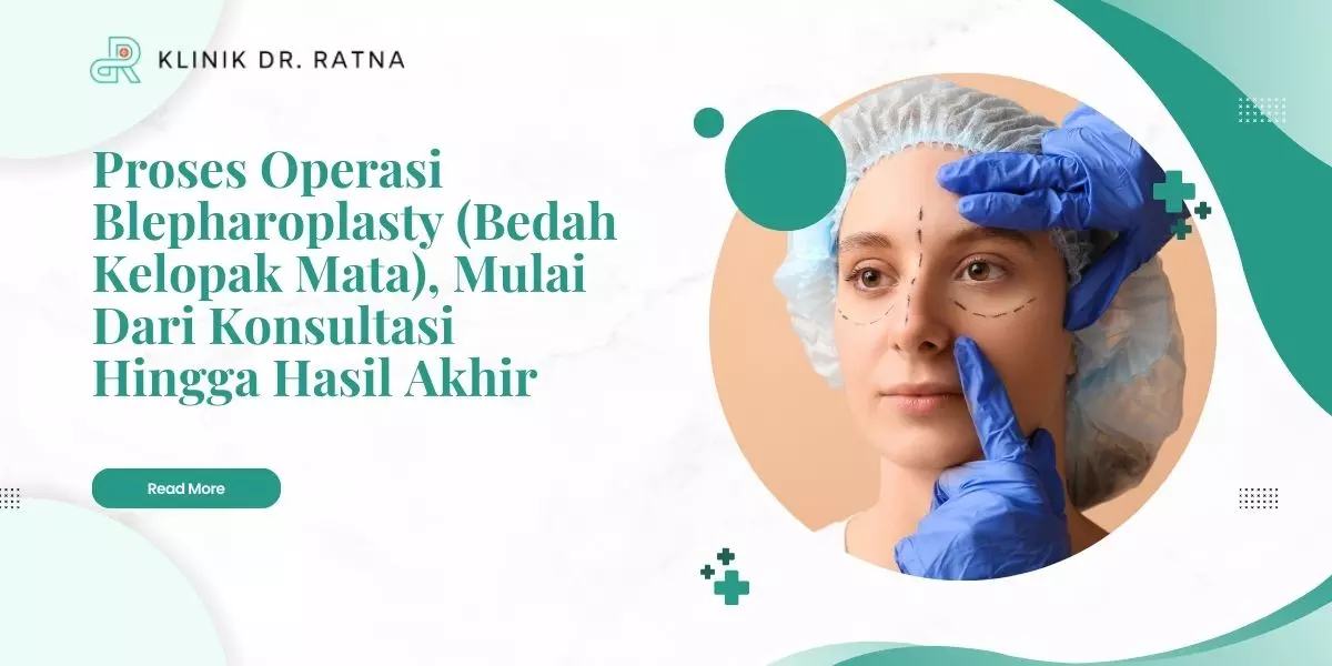 proses operasi blepharoplasty bedah kelopak mata mulai dari konsultasi hingga hasil akhir