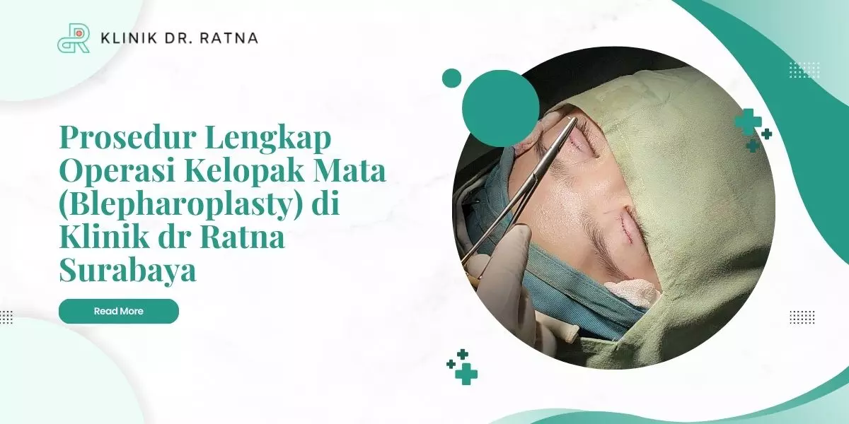 prosedur lengkap operasi kelopak mata blepharoplasty di klinik dr ratna surabaya 19110154204