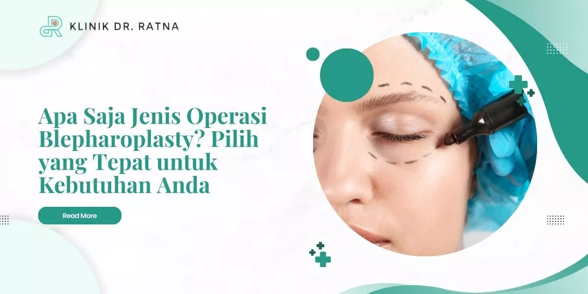 apa saja jenis operasi blepharoplasty pilih yang tepat untuk kebutuhan anda 07100216928