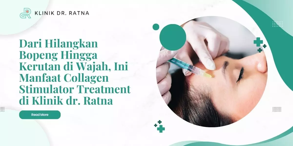 Dari Hilangkan Bopeng Hingga Kerutan di Wajah, Ini Manfaat Collagen Stimulator Treatment di Klinik dr. Ratna