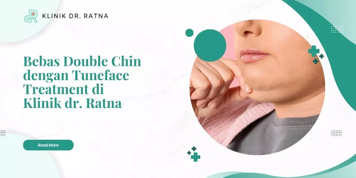 Bebas Double Chin dengan Tuneface Treatment di Klinik dr. Ratna