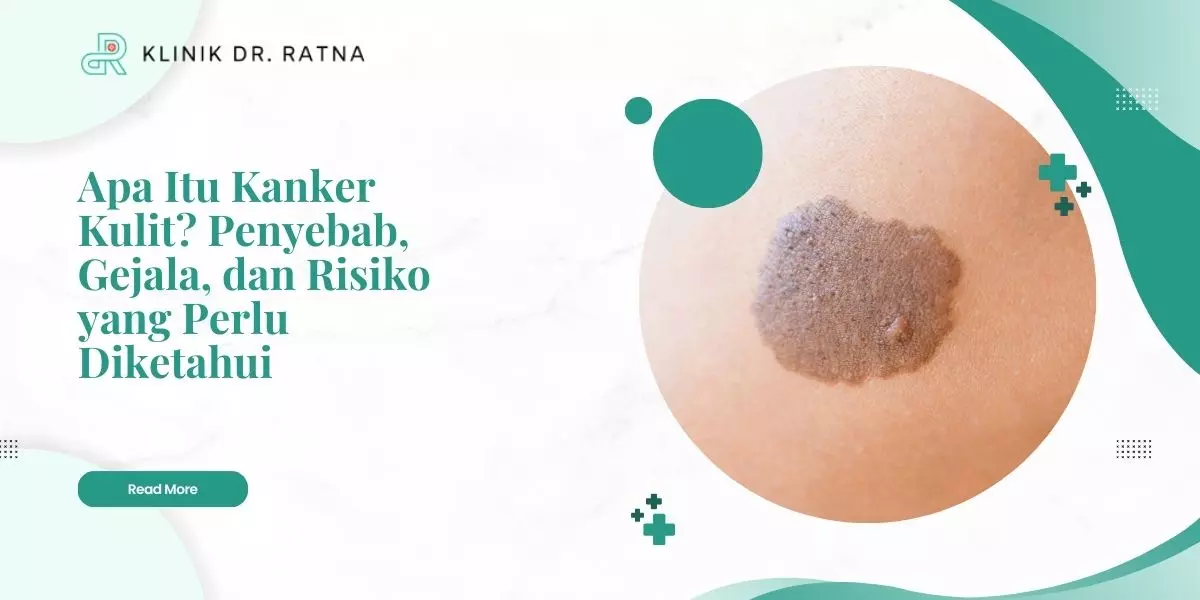 Apa Itu Kanker Kulit? Penyebab, Gejala, dan Risiko yang Perlu Diketahui