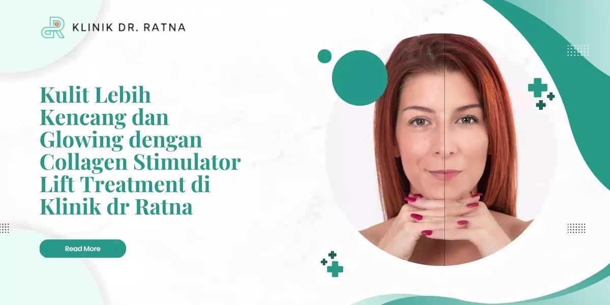 Kulit Lebih Kencang dan Glowing dengan Collagen Stimulator Lift Treatment di Klinik dr Ratna