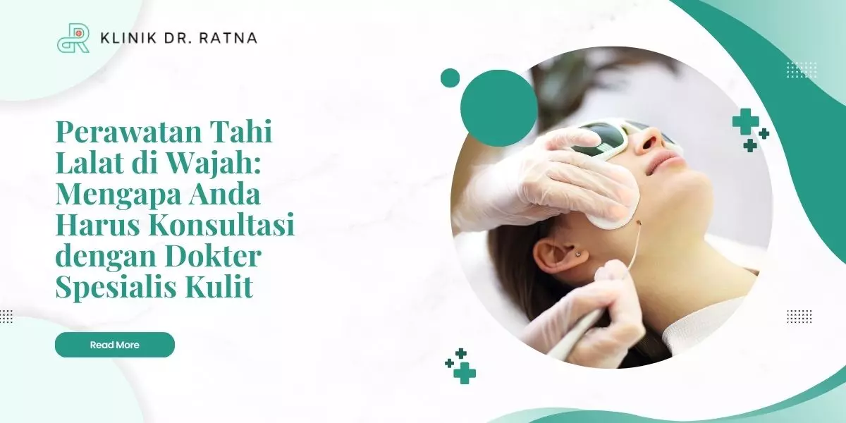 Perawatan Tahi Lalat di Wajah: Mengapa Anda Harus Konsultasi dengan Dokter Spesialis Kulit
