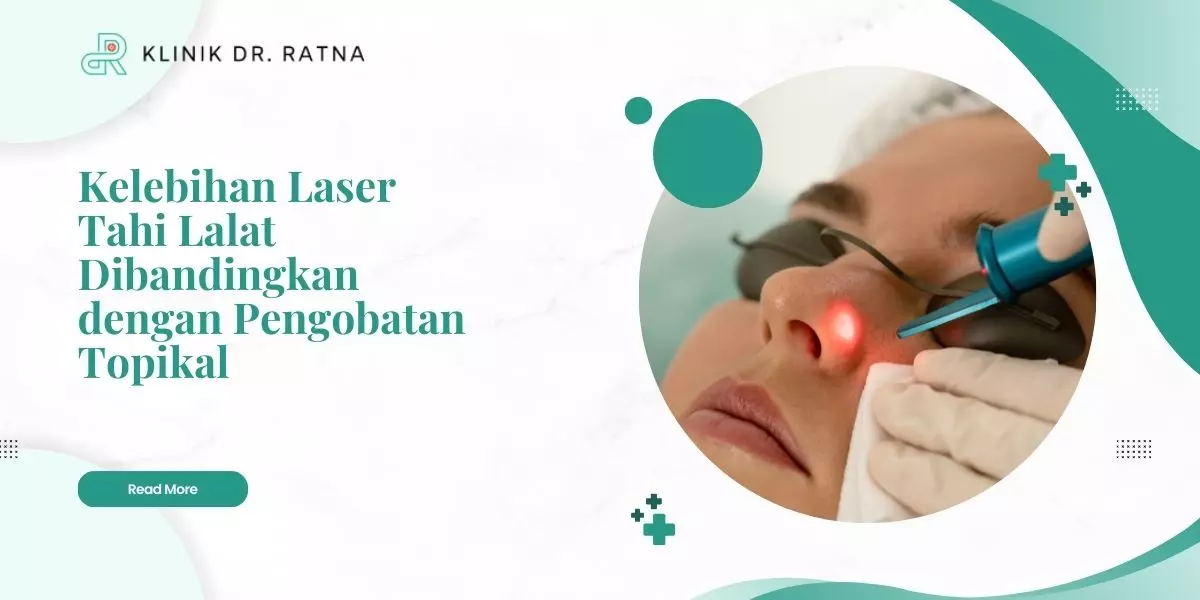 Kelebihan Laser Tahi Lalat Dibandingkan dengan Pengobatan Topikal