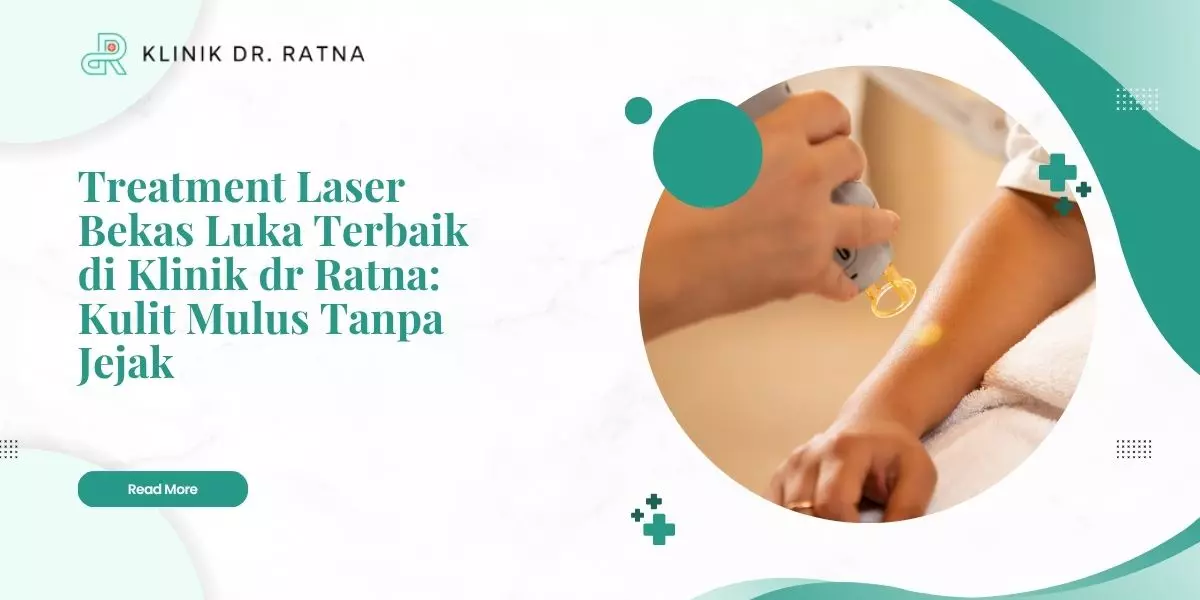 Treatment Laser Bekas Luka Terbaik di Klinik dr Ratna: Kulit Mulus Tanpa Jejak