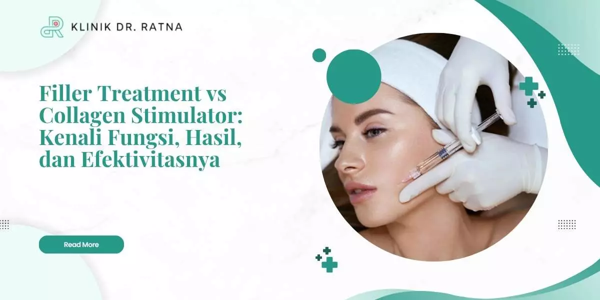 Filler Treatment vs Collagen Stimulator: Kenali Fungsi, Hasil, dan Efektivitasnya