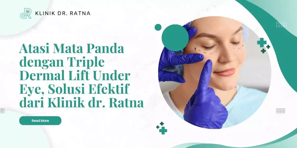 Atasi Mata Panda dengan Triple Dermal Lift Under Eye, Solusi Efektif dari Klinik dr. Ratna