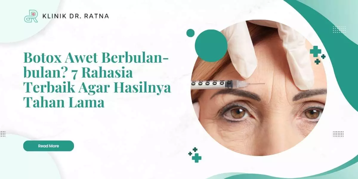 Botox Awet Berbulan-bulan? 7 Rahasia Terbaik Agar Hasilnya Tahan Lama