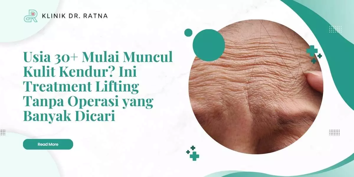 Usia 30+ Mulai Muncul Kulit Kendur? Ini Treatment Lifting Tanpa Operasi yang Banyak Dicari