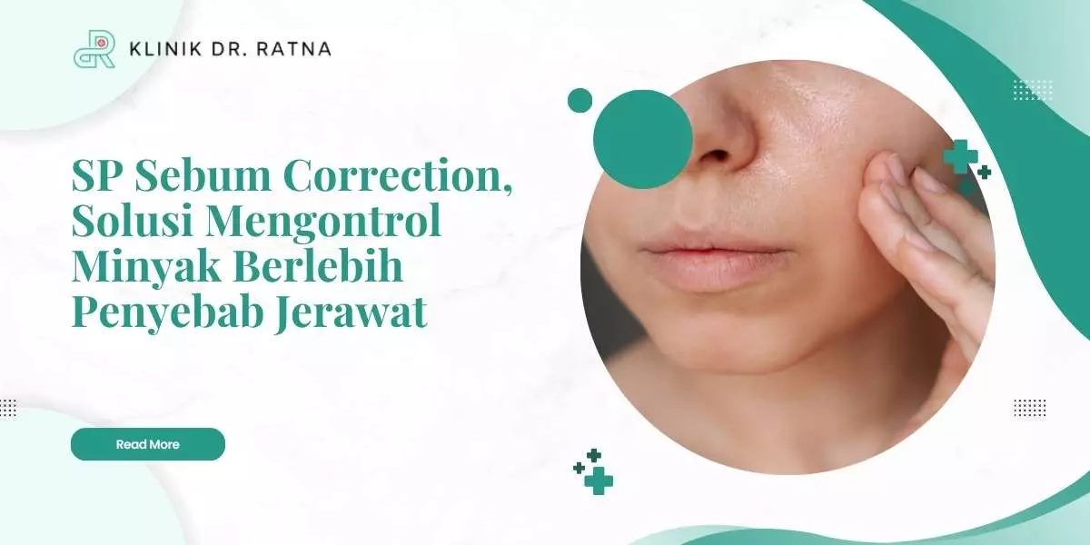 SP Sebum Correction, Solusi Mengontrol Minyak Berlebih Penyebab Jerawat
