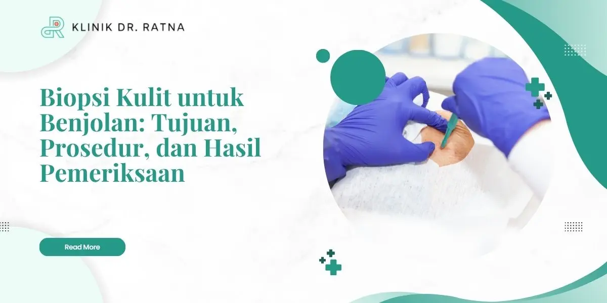 Biopsi Kulit untuk Benjolan: Tujuan, Prosedur, dan Hasil Pemeriksaan