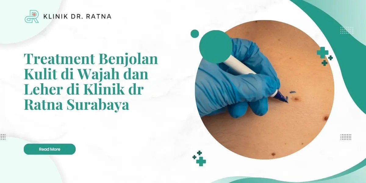 Treatment Benjolan Kulit di Wajah dan Leher di Klinik dr Ratna Surabaya