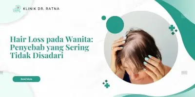 Hair Loss pada Wanita: Penyebab yang Sering Tidak Disadari