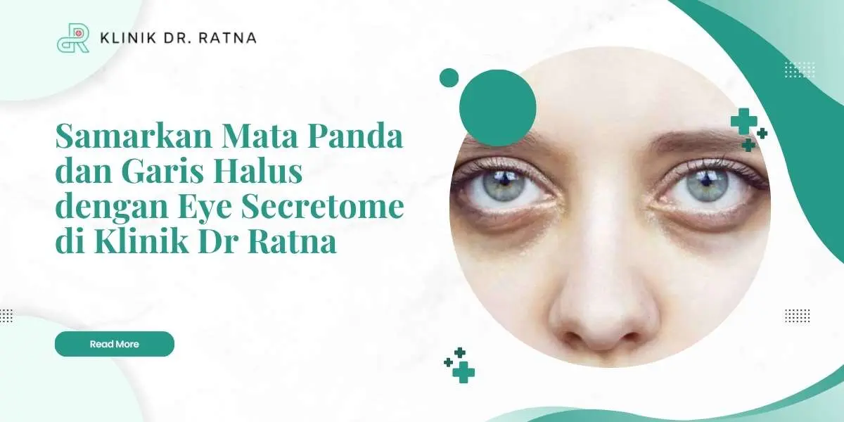 Samarkan Mata Panda dan Garis Halus dengan Eye Secretome di Klinik Dr Ratna