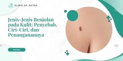 Jenis-Jenis Benjolan pada Kulit: Penyebab, Ciri-Ciri, dan Penanganannya