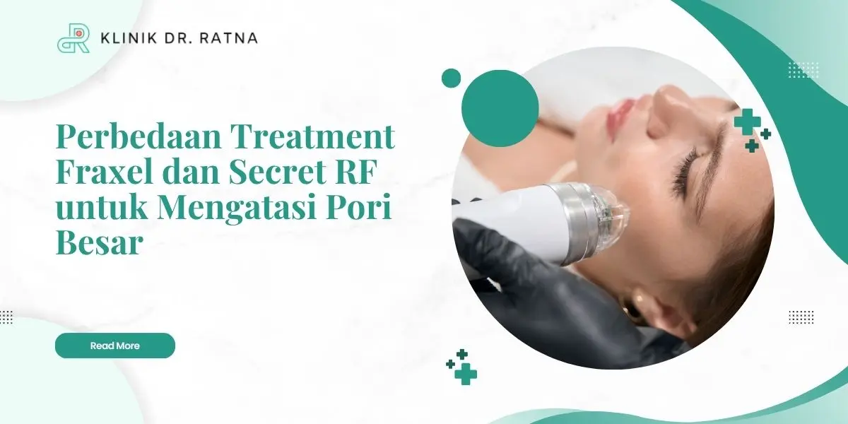 Perbedaan Treatment Fraxel dan Secret RF untuk Mengatasi Pori Besar