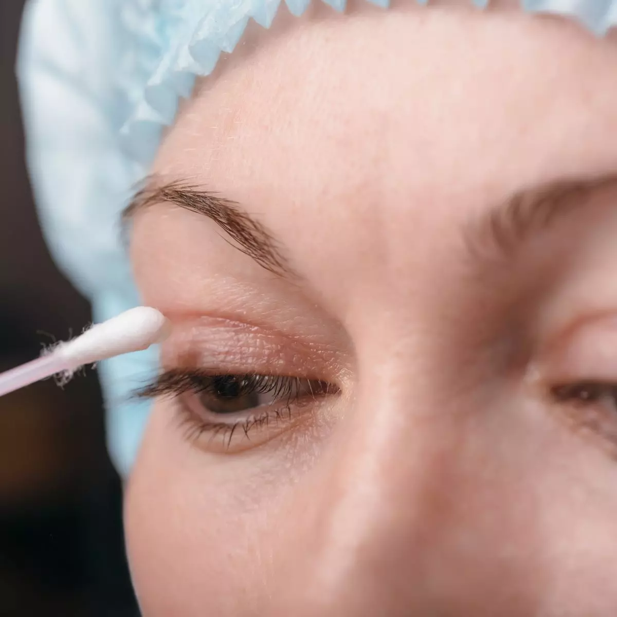 Manfaat Double Eyelid Surgery