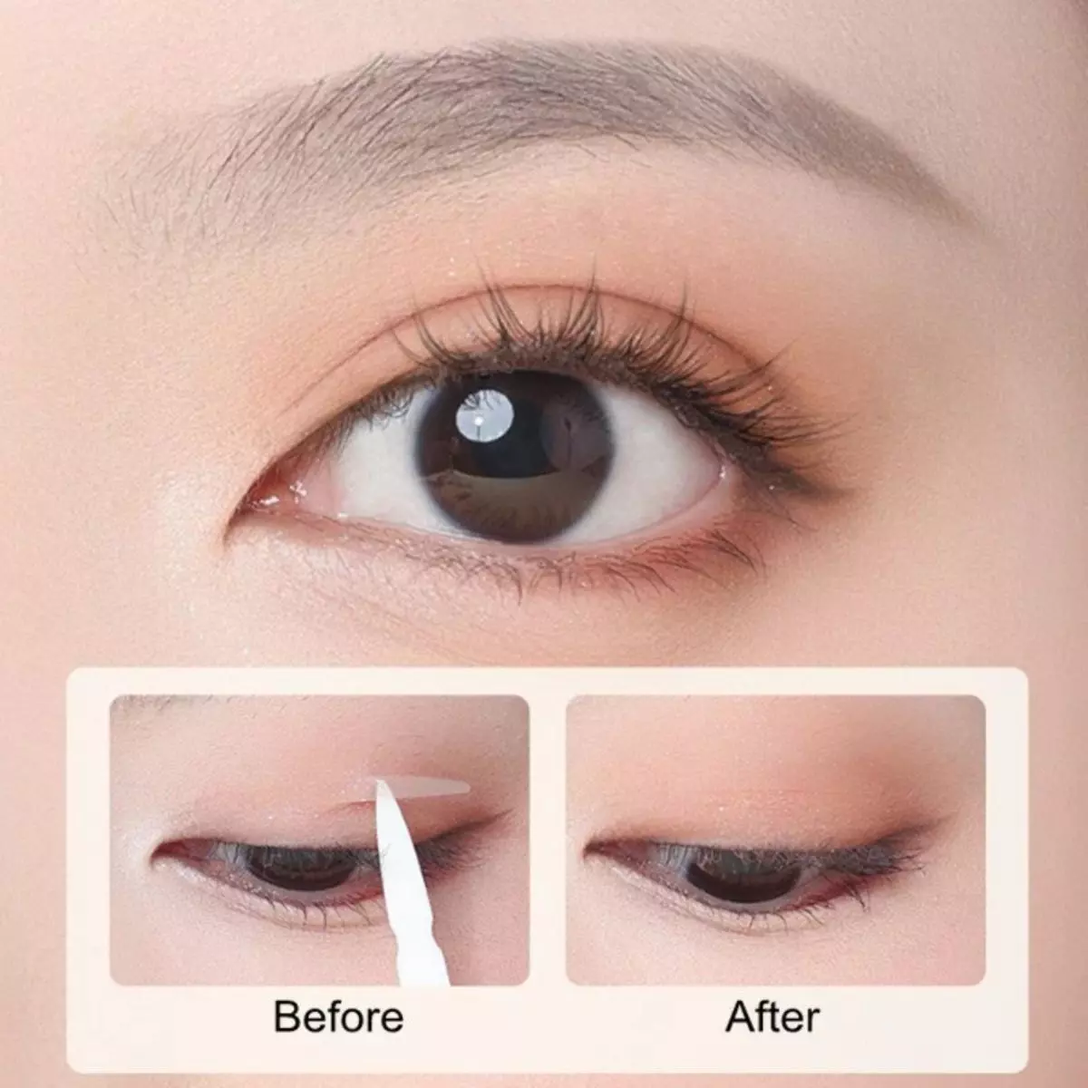 Alternatif Double Eyelid Non-Bedah, Pertimbangan Manfaat dan Risiko
