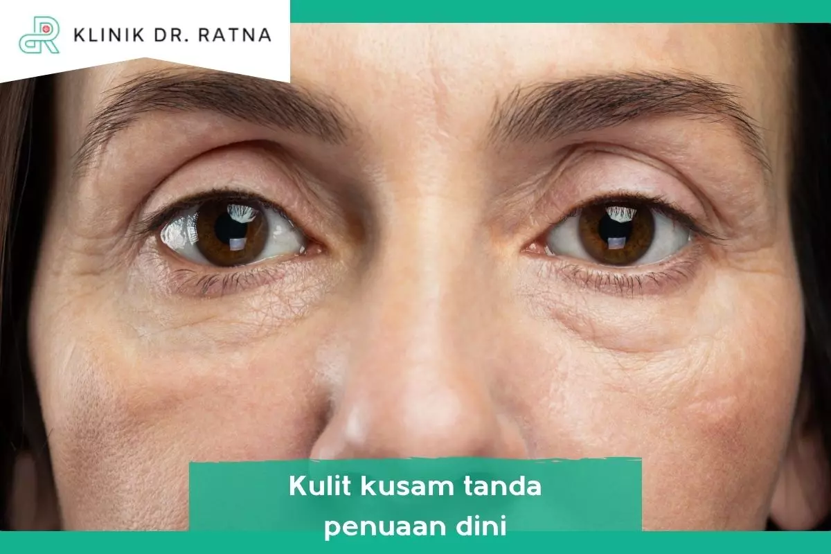 1. Kulit Kusam