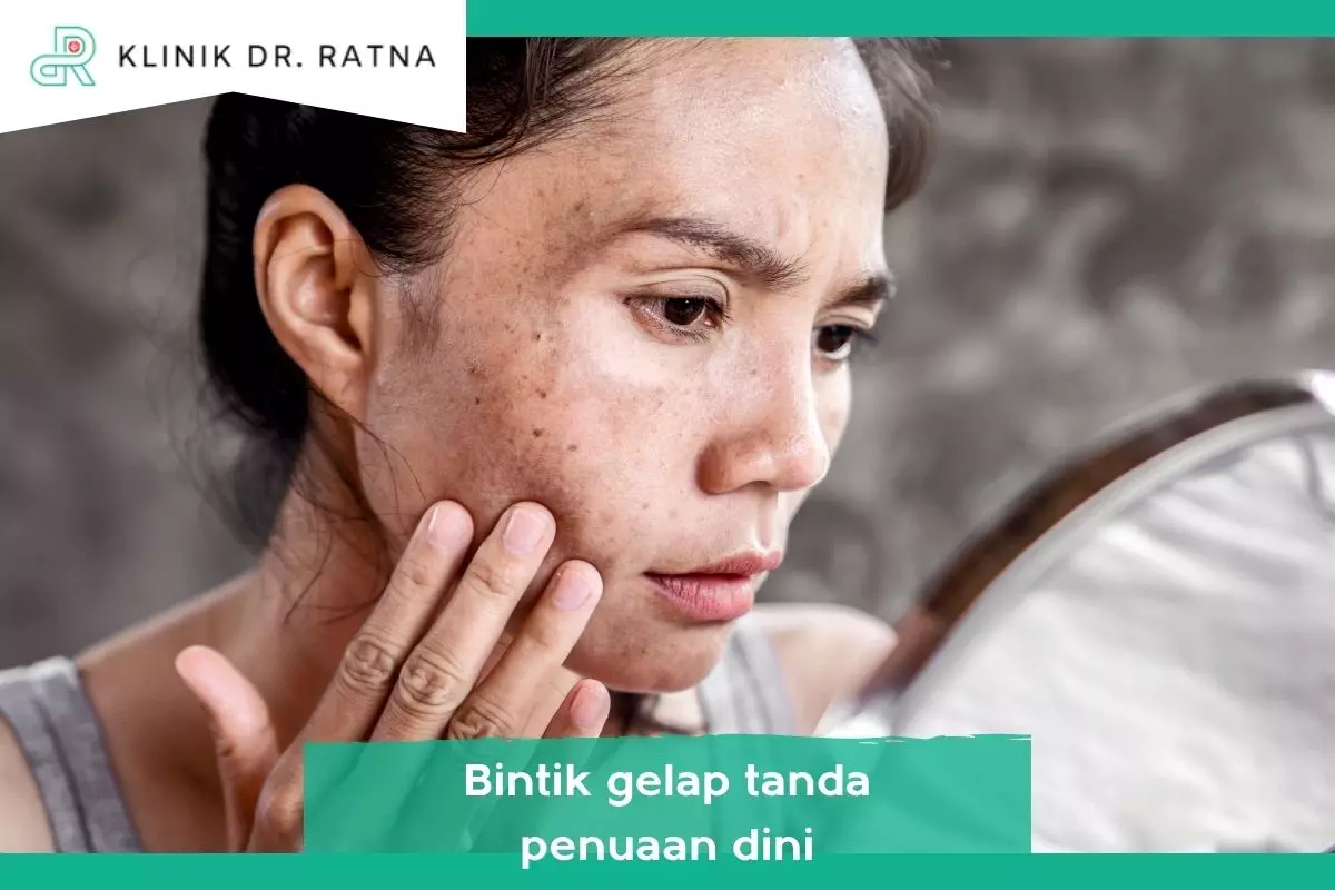 4. Munculnya Bintik-Bintik Gelap