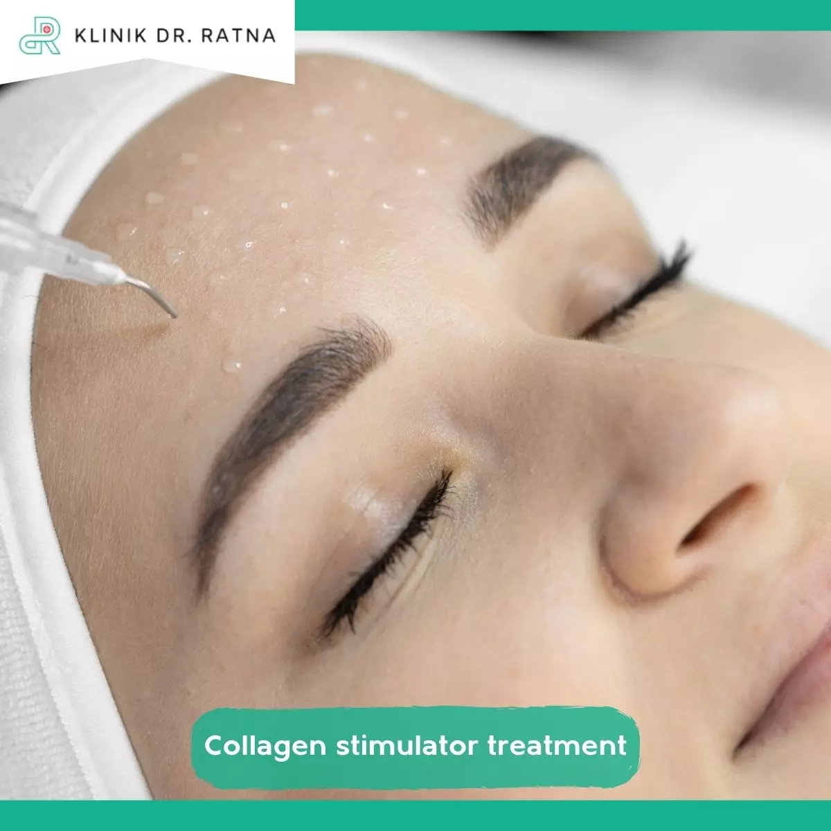 Apa Itu Collagen Stimulator?