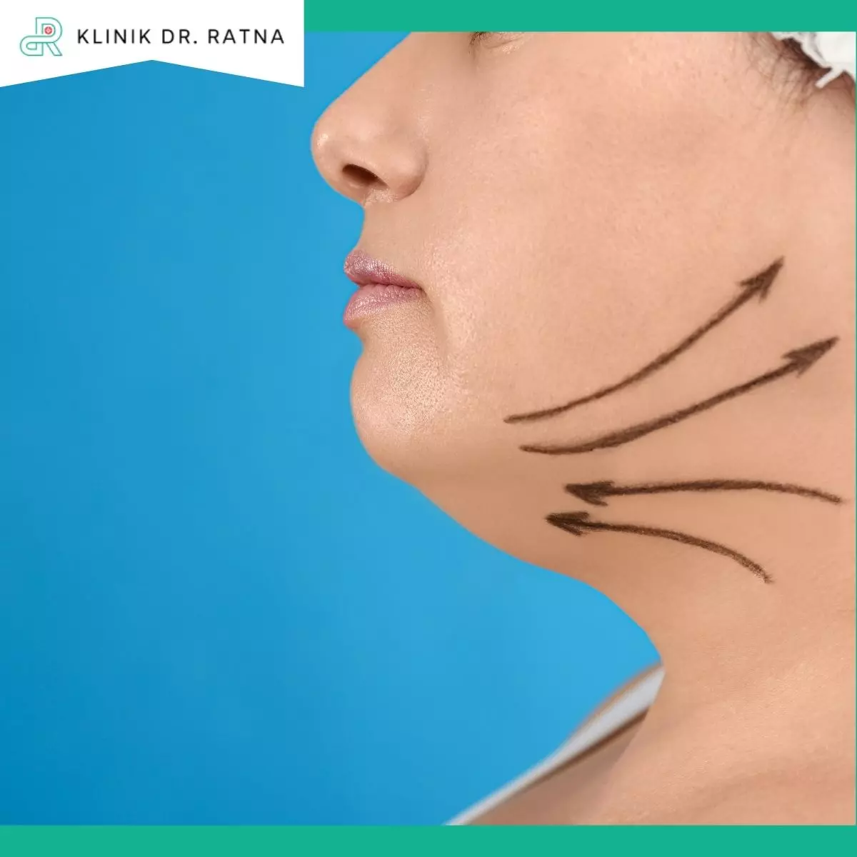 Keunggulan Tuneface Treatment
