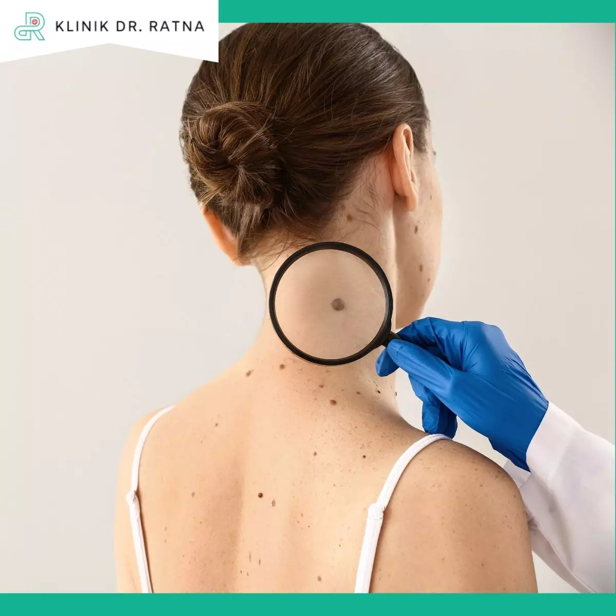 Kapan Harus Berkonsultasi dengan Dokter Kulit?