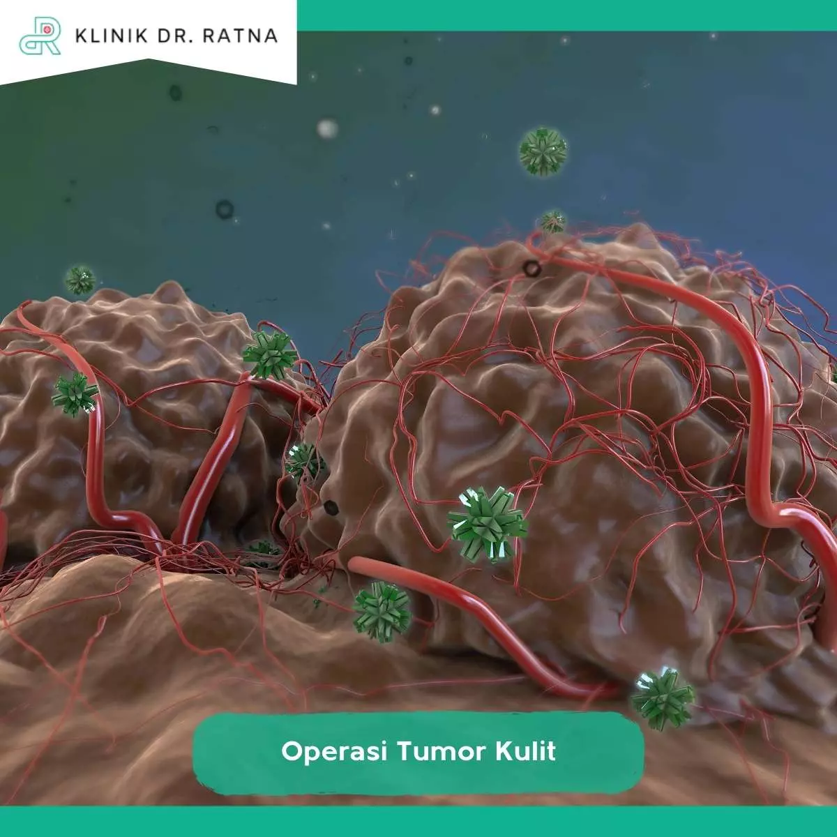 Indikasi Tumor Kulit