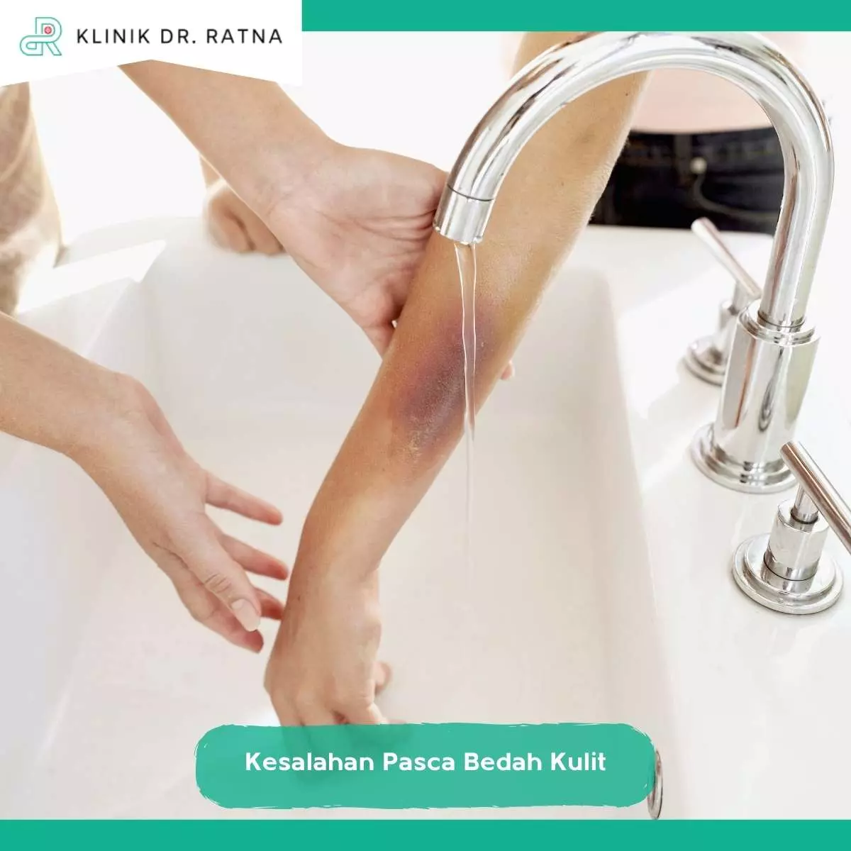 Kesalahan Umum dalam Perawatan Luka Pasca Operasi Kulit