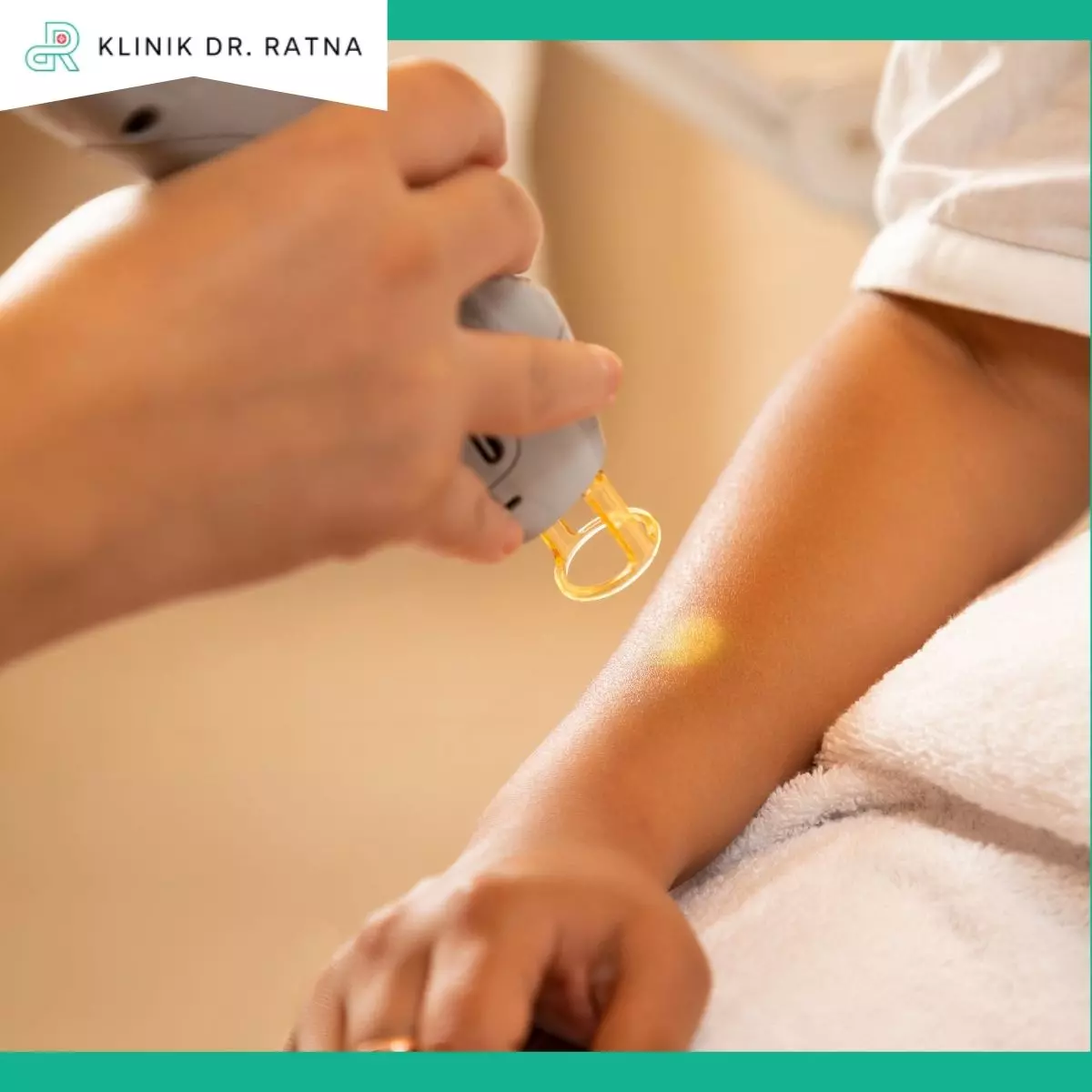 Keunggulan Treatment Laser di Klinik dr Ratna