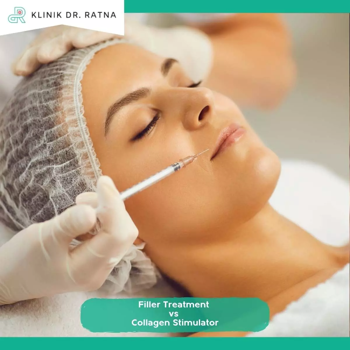 Apa Itu Filler Treatment dan Collagen Stimulator?