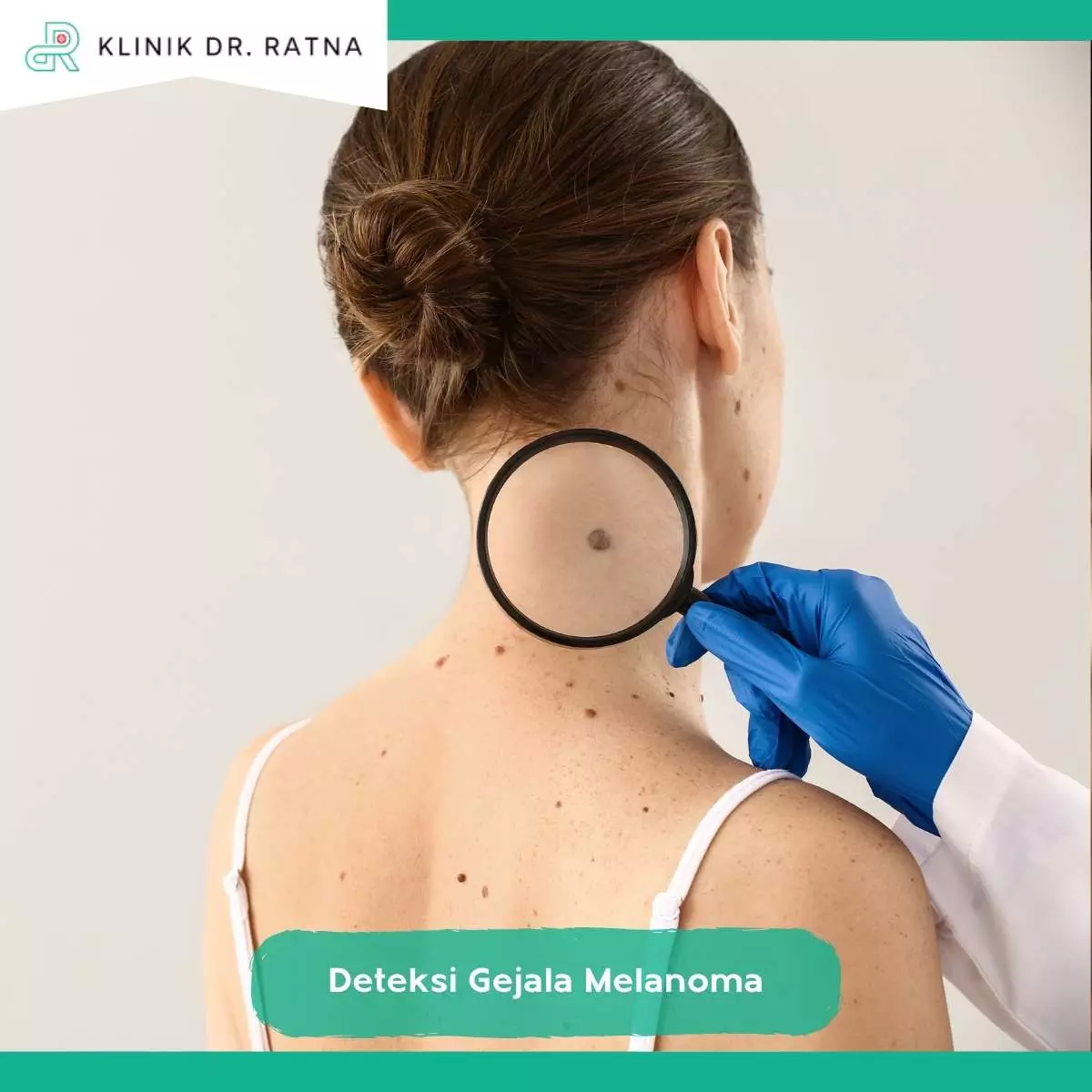 Faktor Melanoma
