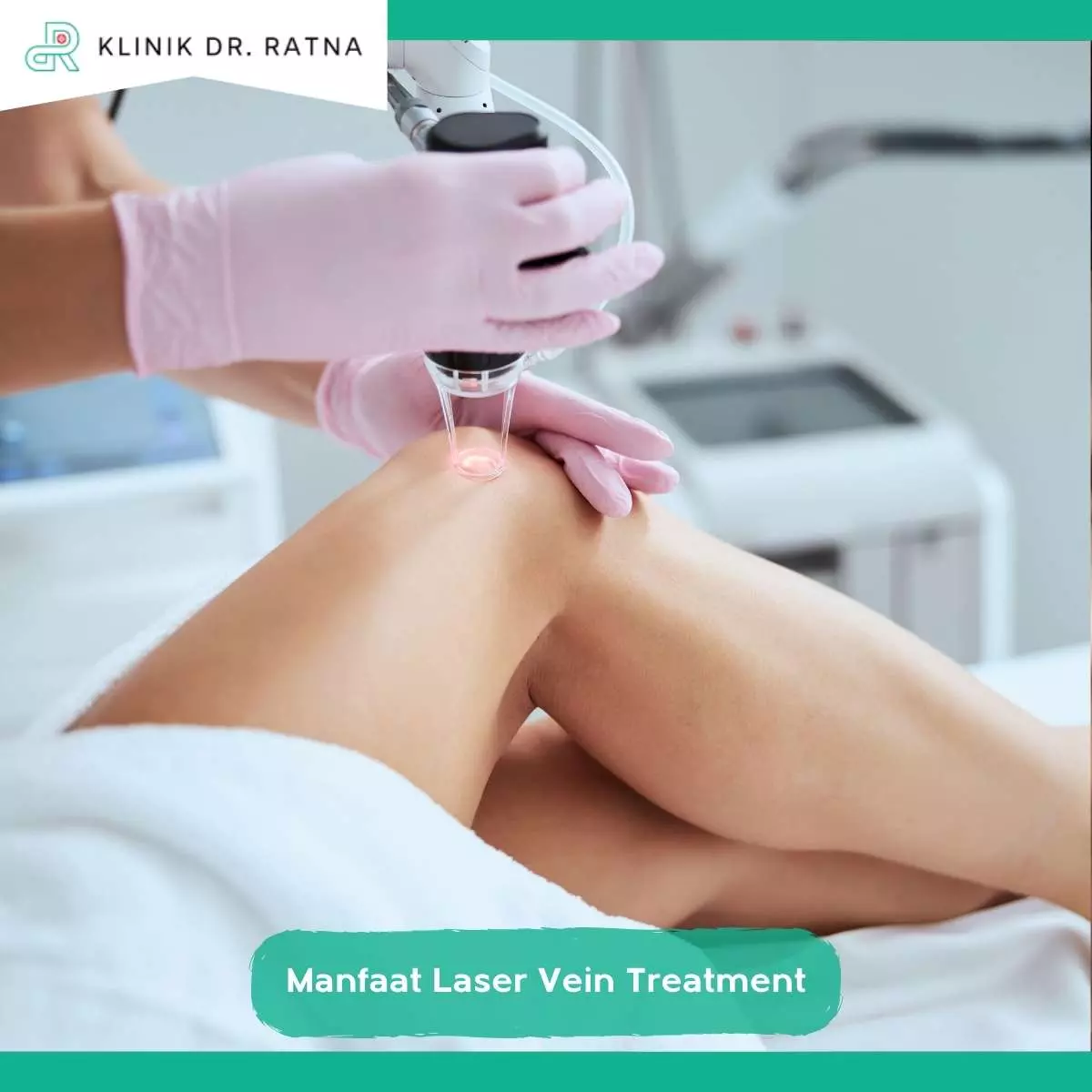 Keamanan dan Efektivitas Laser Vein Treatment Varises