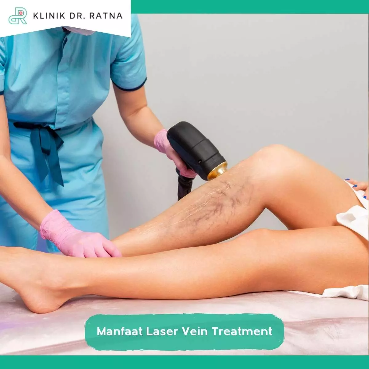 Perbandingan Laser Vein Treatment Varises dengan Metode Lain
