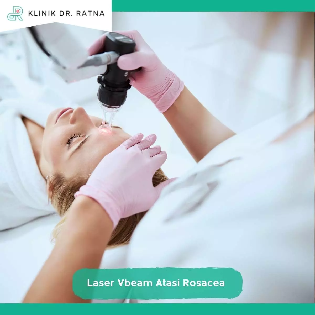 Alasan Laser Vbeam Jadi Pilihan Tepat untuk Atasi Rosacea