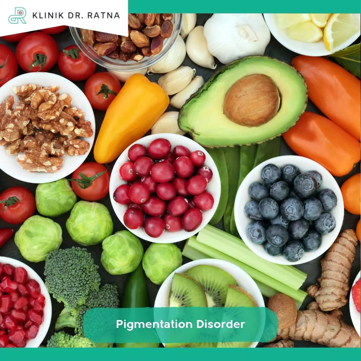 Mencegah Pigmentation Disorder