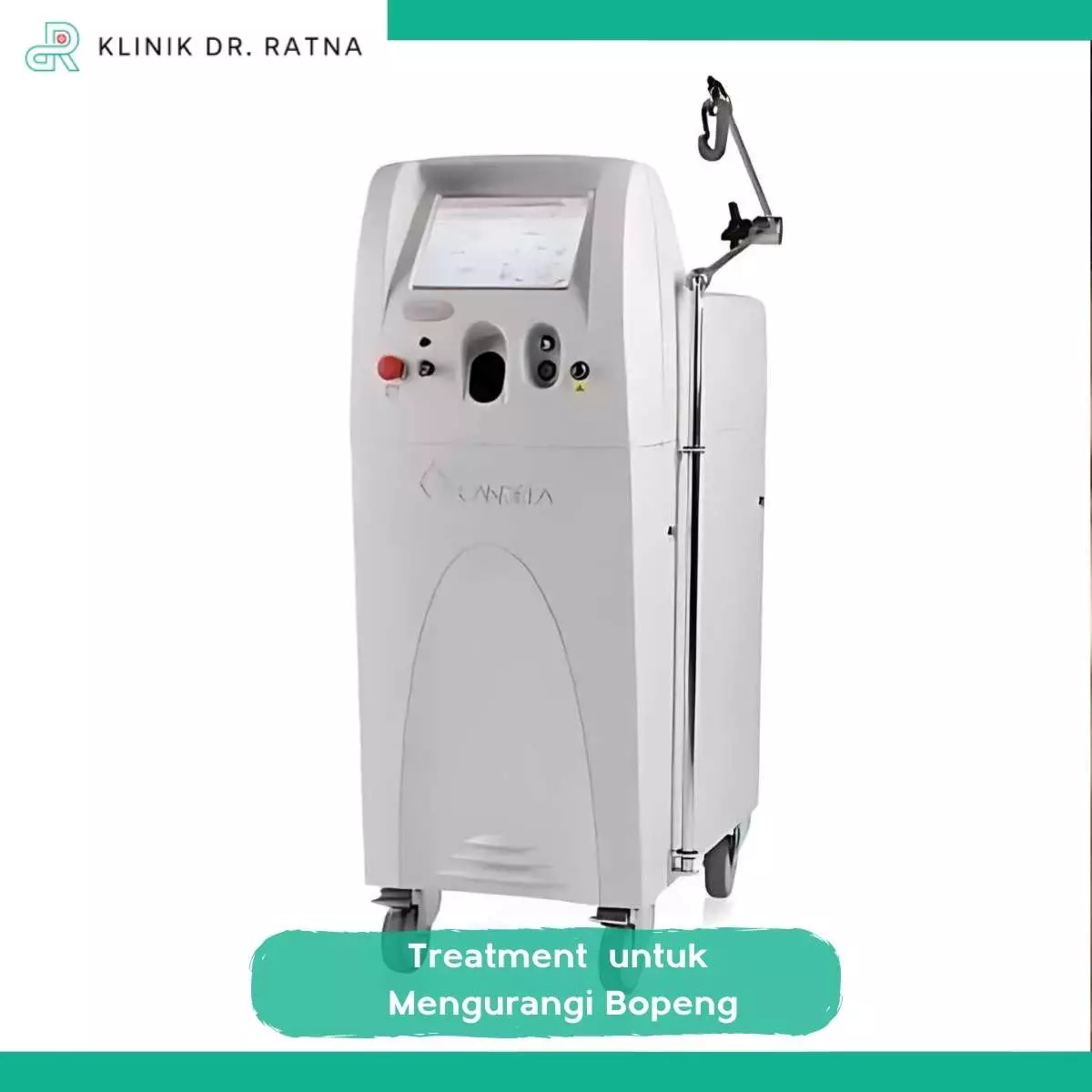 Tips Perawatan Setelah Treatment Bopeng Terbaik
