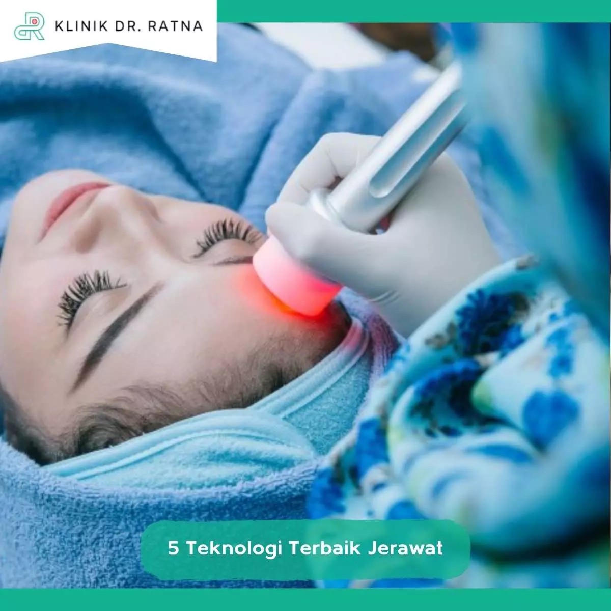 Penyebab dan Jenis Jerawat