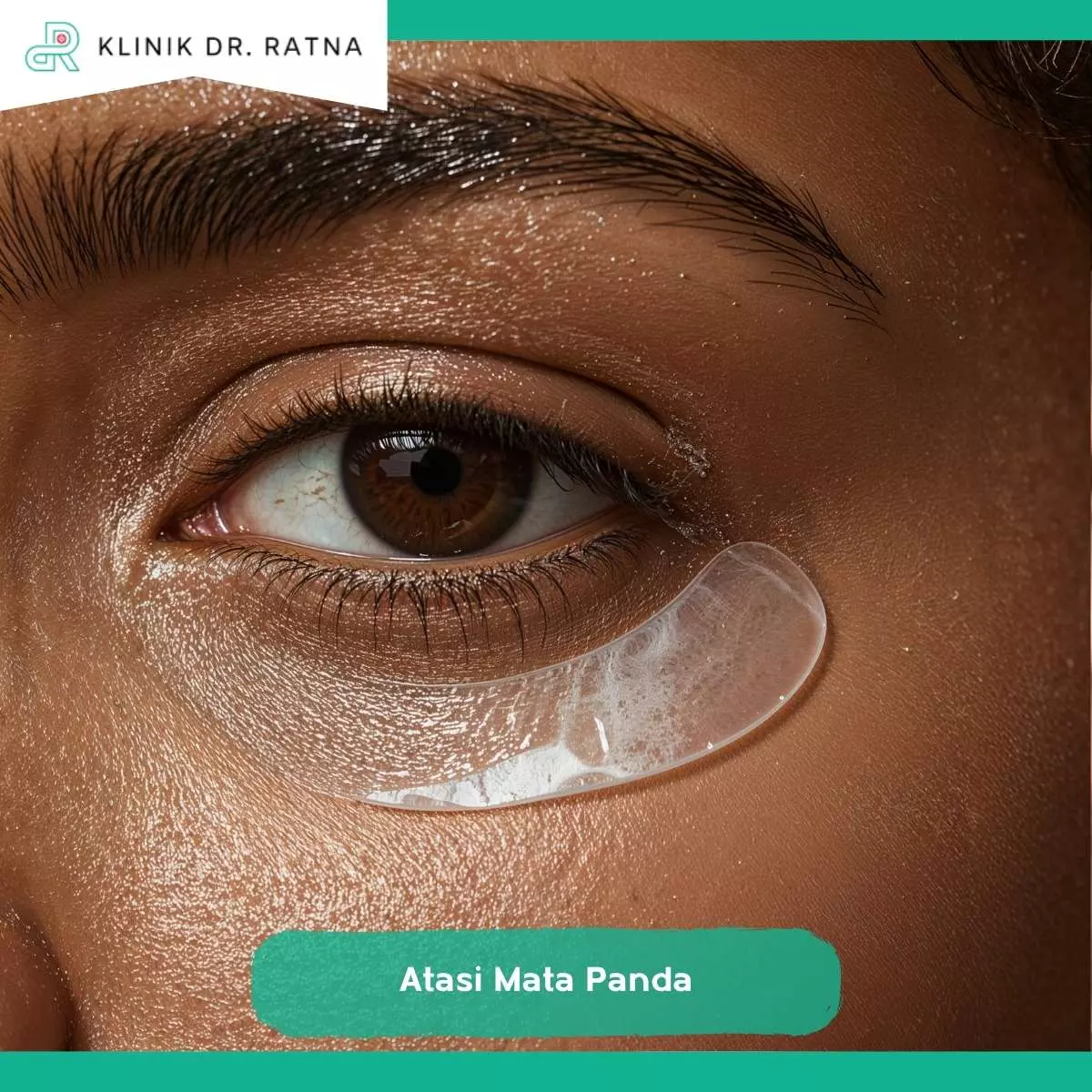 Mengenal Triple Dermal Lift Under Eye