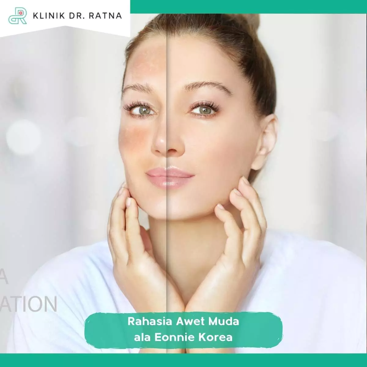 3 Efek Instan Setelah Treatment