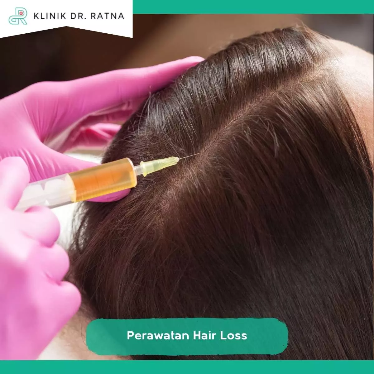 Keunggulan Treatment Rambut Rontok Klinik Dr Ratna