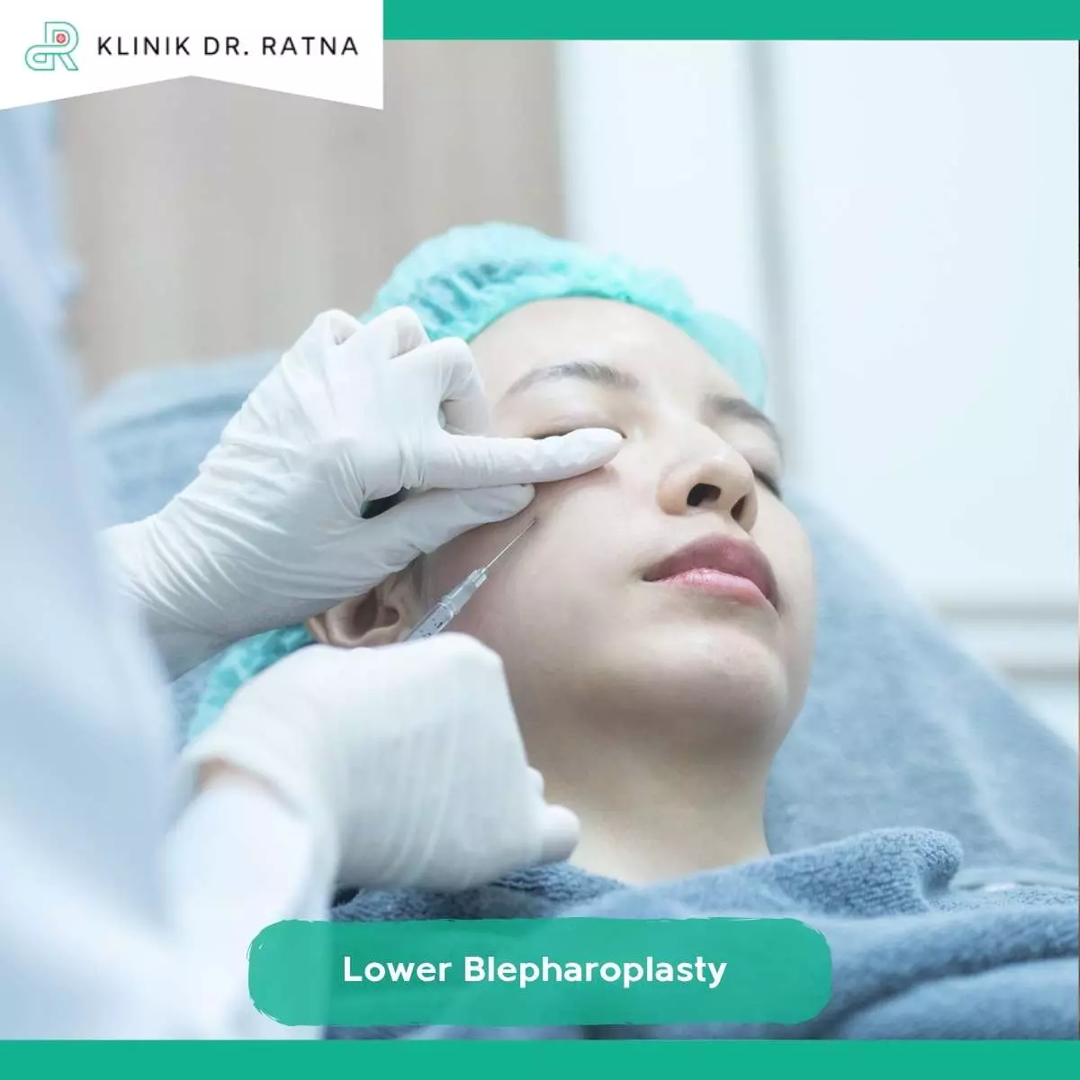 Apa Itu Lower Blepharoplasty?