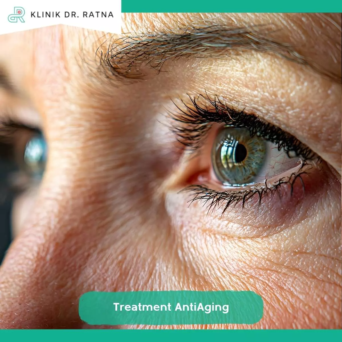 Pentingnya Melakukan Treatment Anti Aging di Usia 30-40