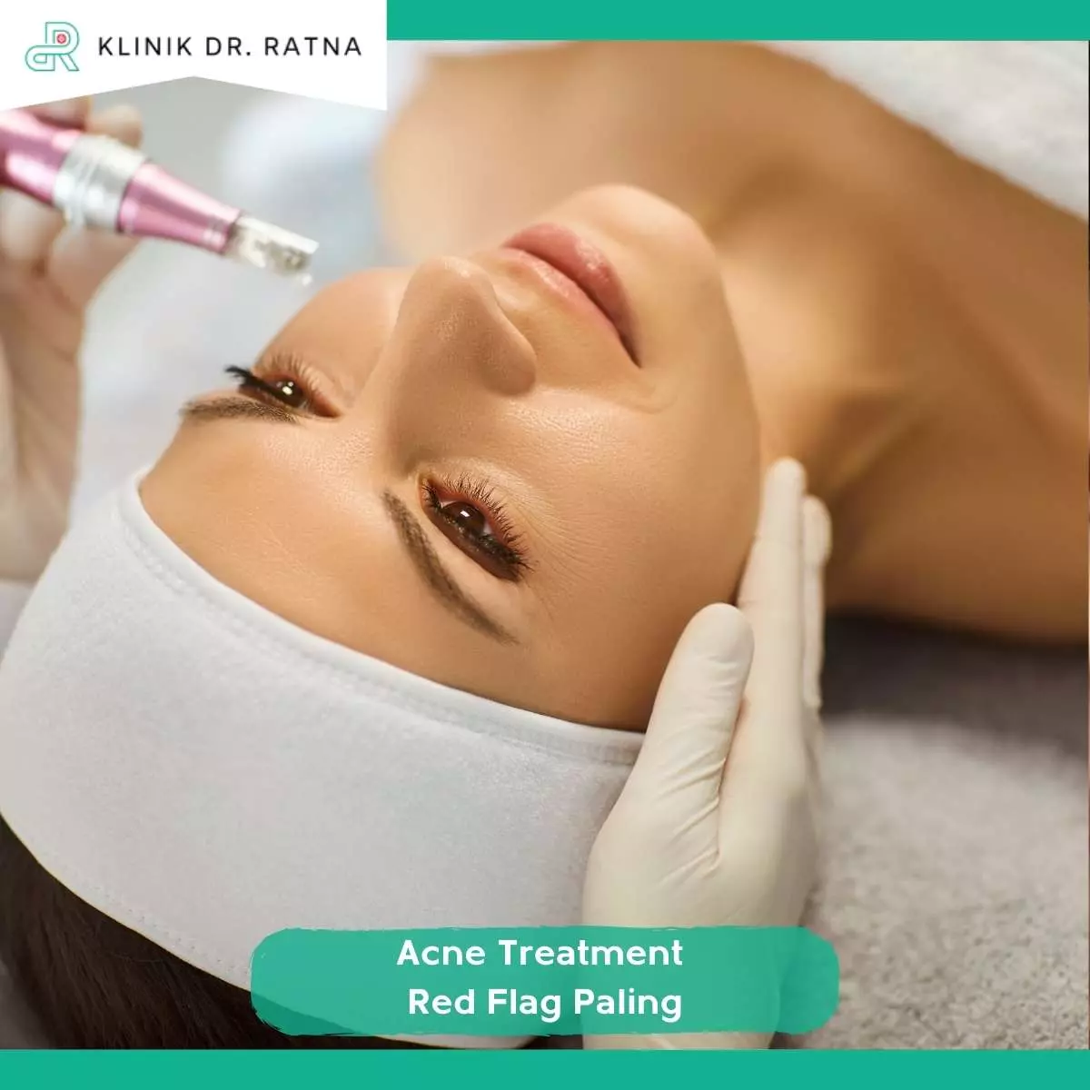 Jangan Asal Treatment, Kenali Acne Treatment Red Flag Paling Berbahaya Sebelum Terlambat