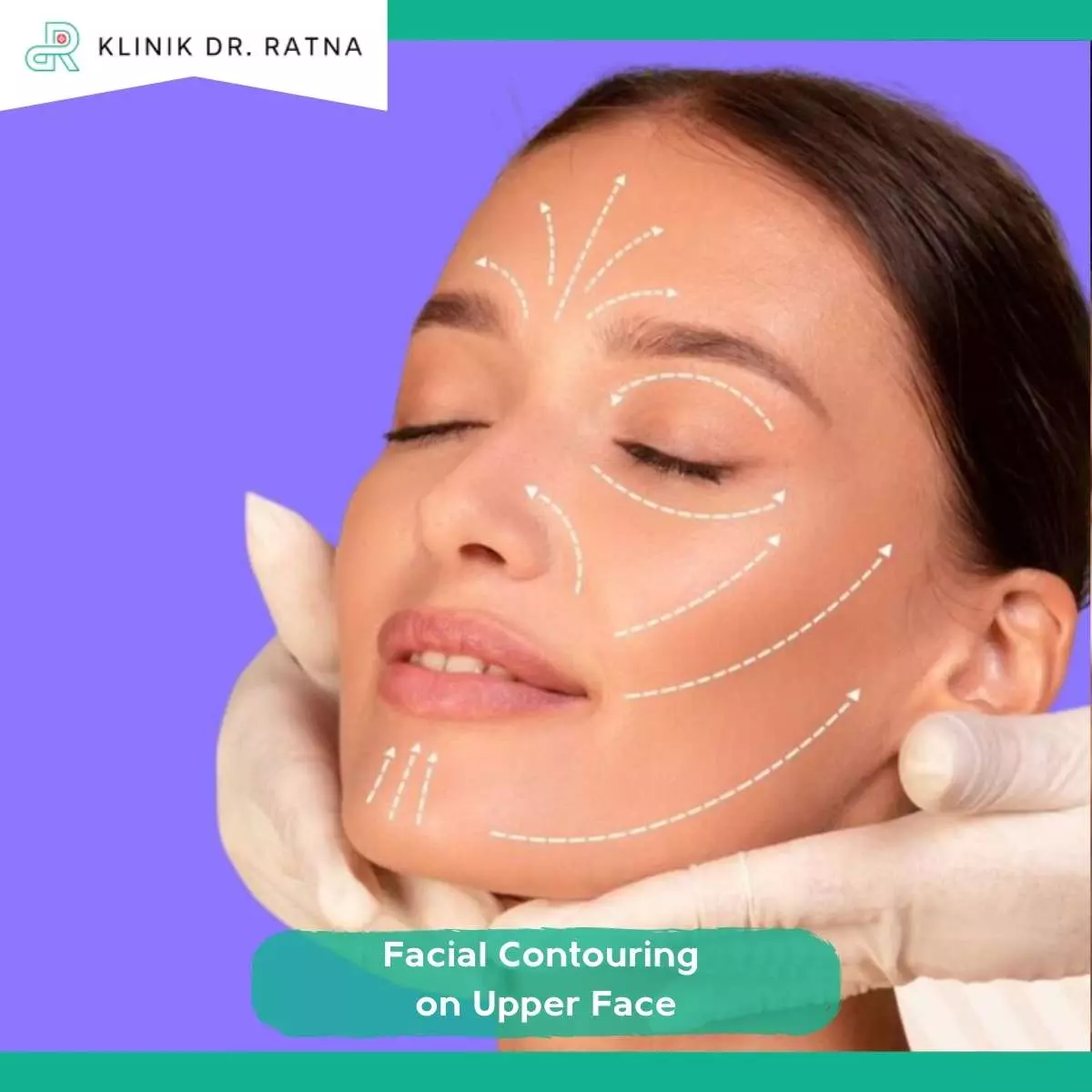 Keamanan dan Efek Samping Facial Contouring Upper Face