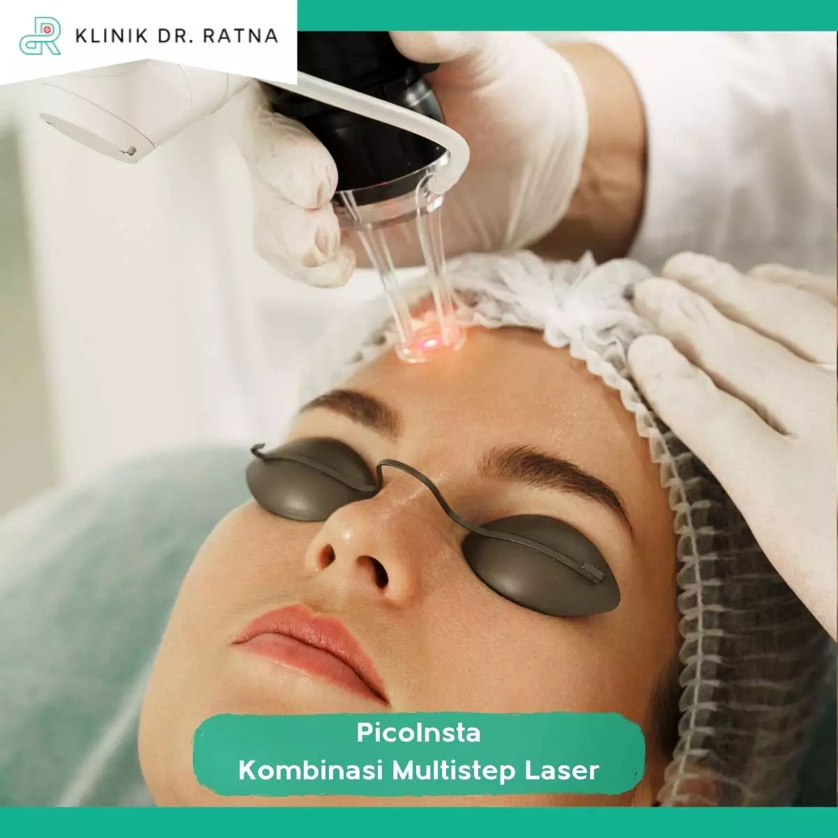 Cara Kerja PicoInsta Laser untuk Kulit Wajah
