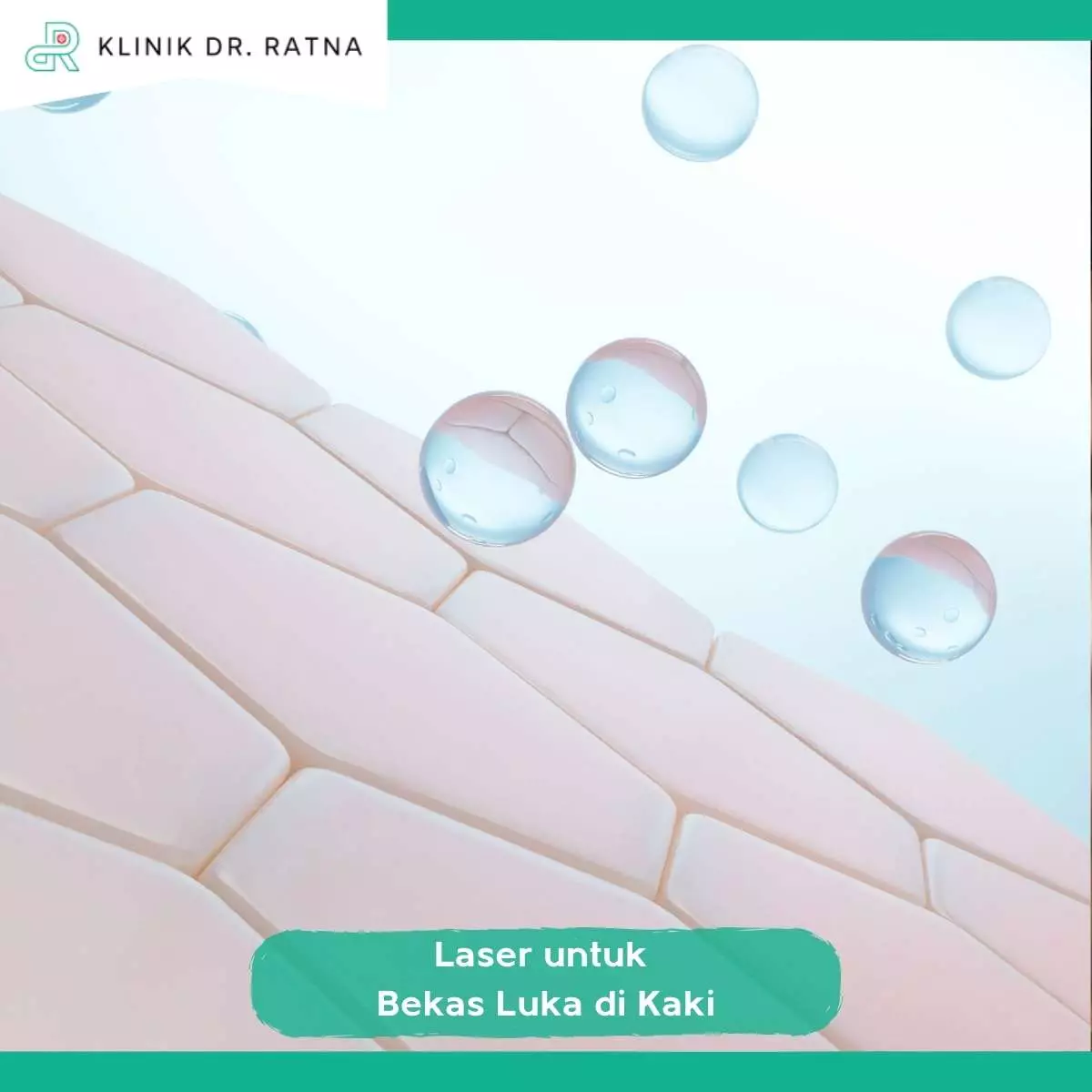 Manfaat Laser Bekas Luka Kaki Dibanding Metode Lain