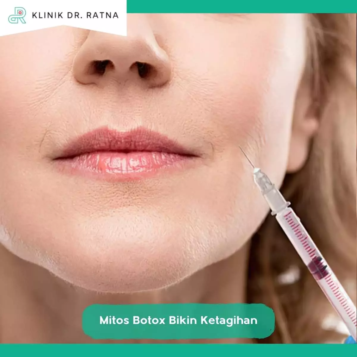Mitos-Mitos Lain Seputar Botox
